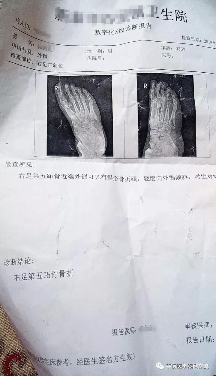 右脚趾骨折医院检查报告
